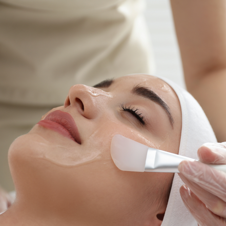 Chemical Peels
