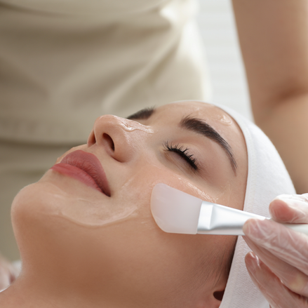 Chemical Peels