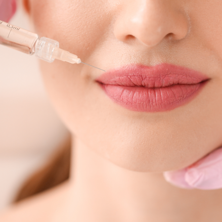 Cosmetic Injections & Fillers